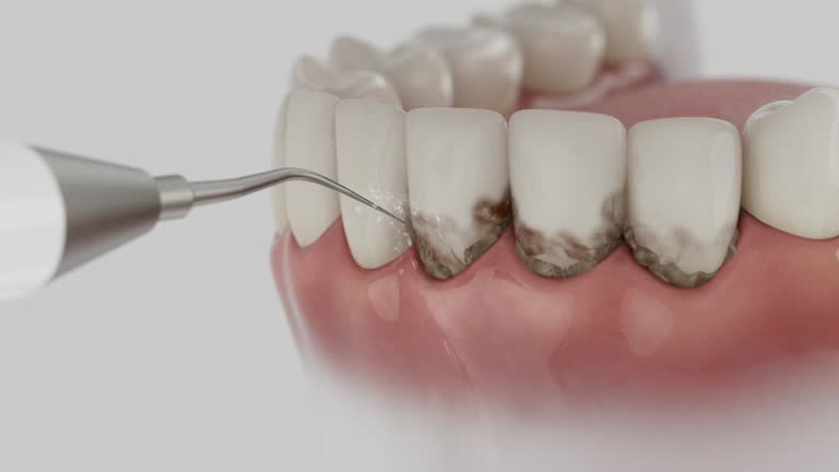 Trusted Dental Implants service in Seco Mines, TX - Dentist Open Now